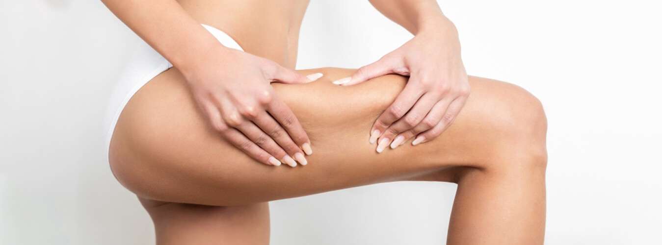 What is cellulite ? Cellulite treatment in South Delhi, Saket at