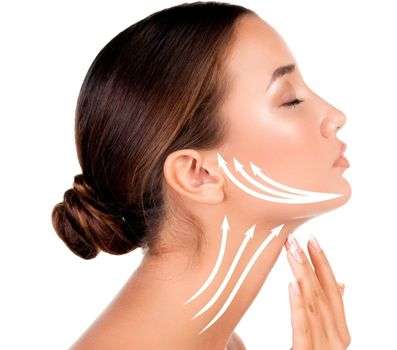 Neck Lift