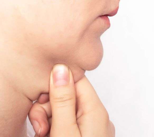 Why choose SkinQure for Double Chin