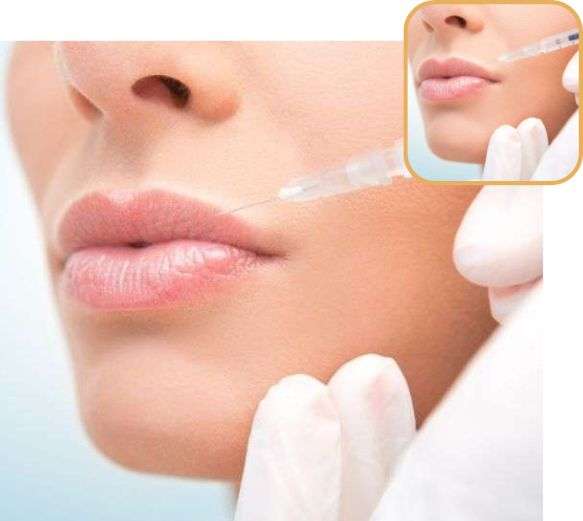 Why choose SkinQure for Lip Enhancement