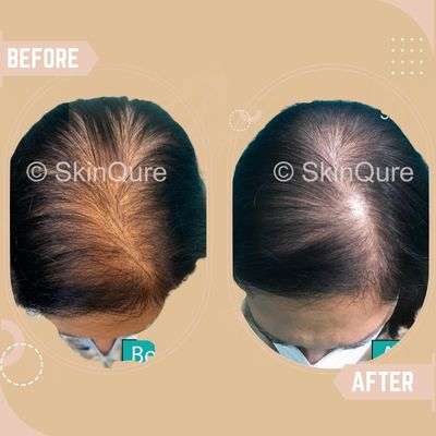 Female Hair Loss 2