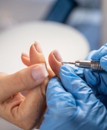 Nail Surgery