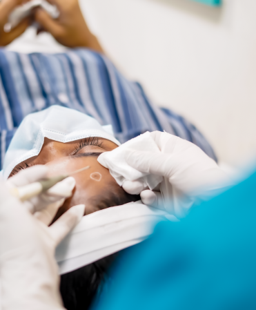 Mole Removal
