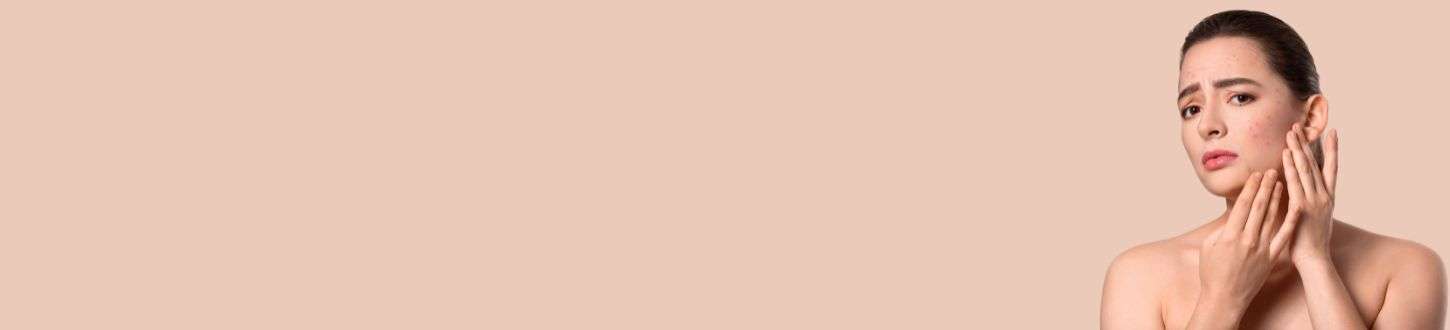 Looking for the Best Dermatologist in Punjabi Bagh, West Delhi? Visit SkinQure