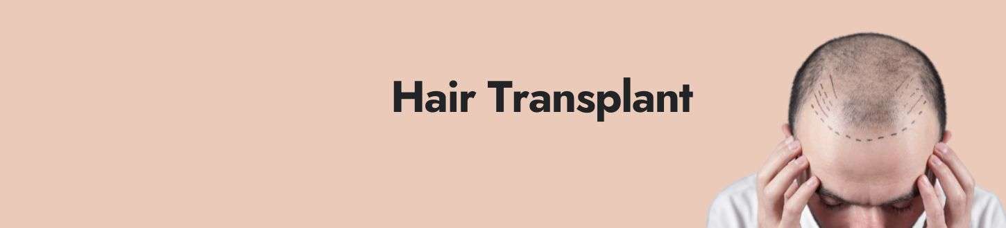 Hair Transplant in Delhi: Affordable, Advanced, and Assured Results at SkinQure