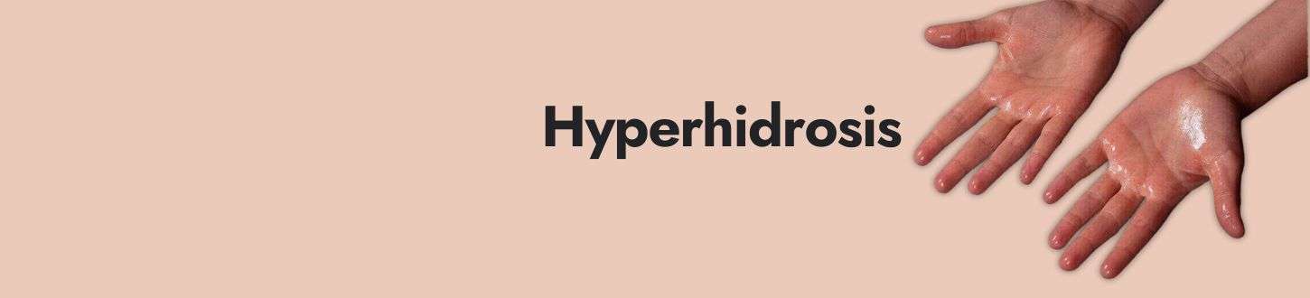 Hyperhidrosis or Excessive Sweating: Causes and Effective Treatments in Delhi