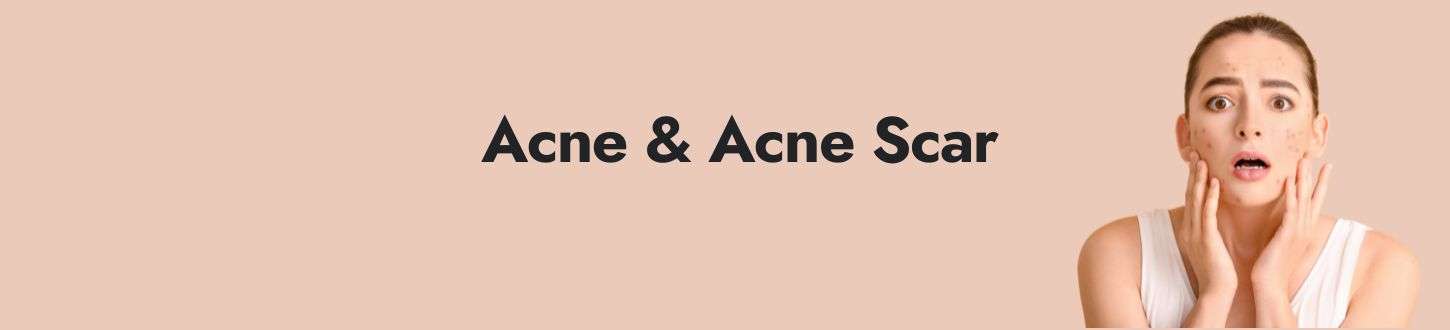 Understanding Acne & Acne Scar Treatment Cost in Delhi