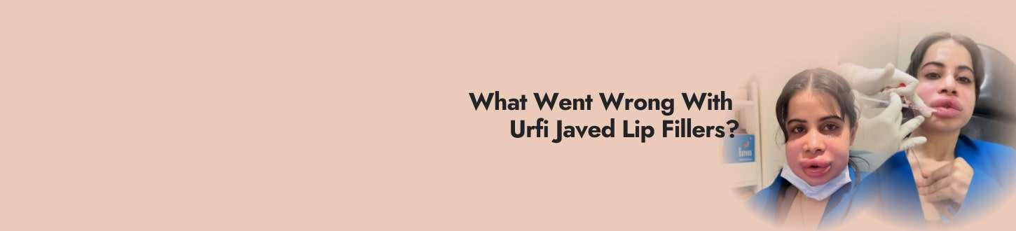 Urfi Javed Face Swelling: The Truth Behind Her Lip Fillers Being Dissolved