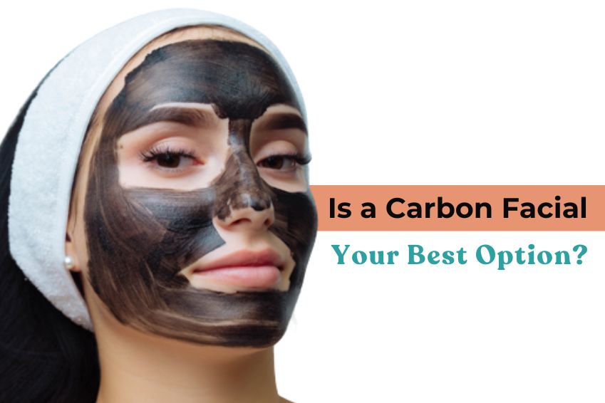 Is a Carbon Facial Your Best Option?