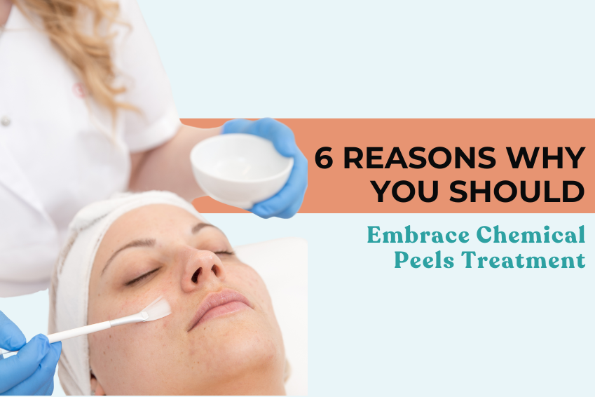 6 Reasons Why You Should Embrace Chemical Peels Treatment