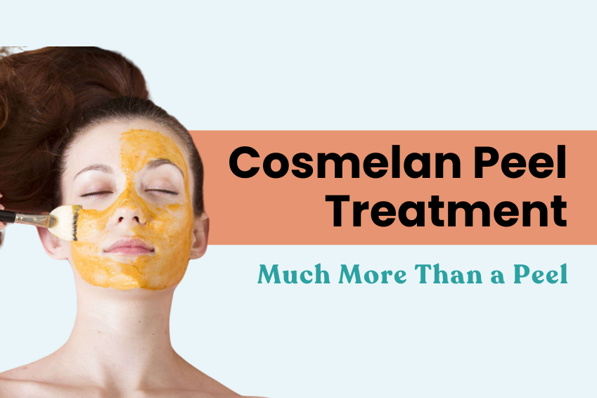 Cosmelan Peel Treatment: Much More Than a Peel