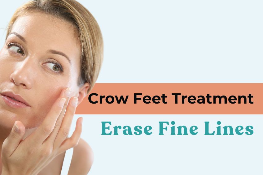 Crow Feet Treatment – Erase Fine Lines