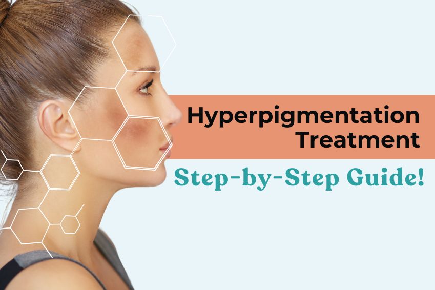 Hyperpigmentation Treatment Step by Step Guide