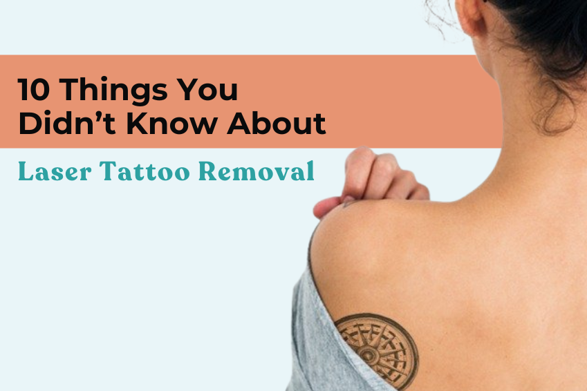 10 Things You Didn’t Know About Laser Tattoo Removal