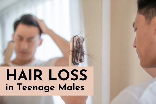 What causes hair loss in teenage males?
