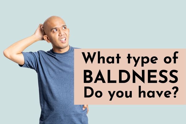 Do you know what type of baldness you have?