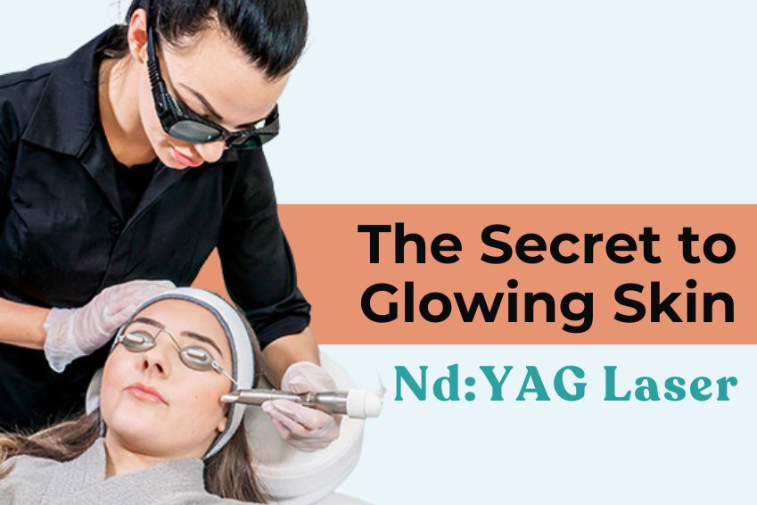 Nd:YAG Laser: The Secret to Glowing Skin