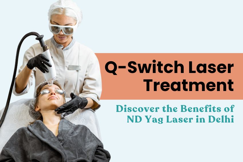 Q-Switch Laser Treatment: Discover the Benefits of ND Yag Laser in Delhi