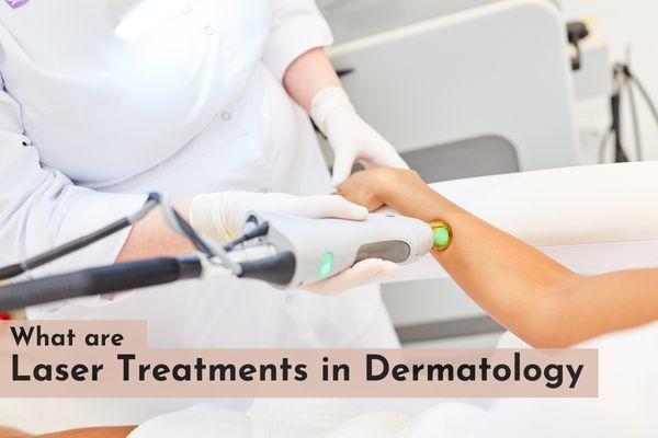 What are laser treatments in dermatology?