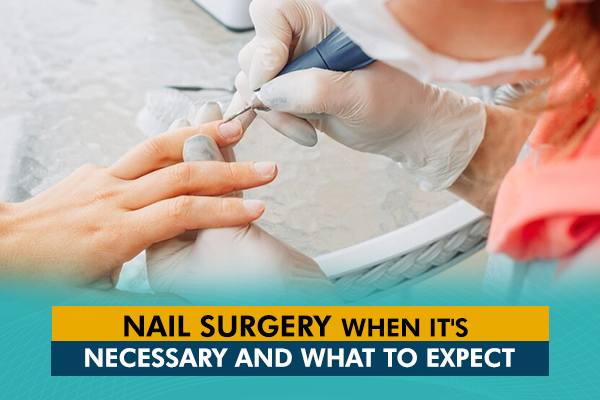 Nail Surgery: When It’s Necessary and What to Expect
