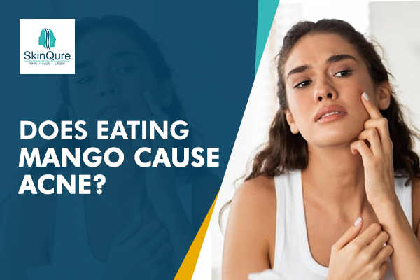 Does Eating Mango Cause Acne?