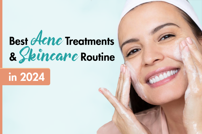 Best Acne Treatments and Skincare Routine in 2024
