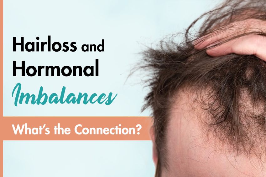 Hair Loss and Hormonal Imbalances – What’s the Connection? 