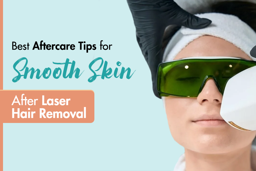 Best Aftercare Tips for Smooth Skin After Laser Hair Removal