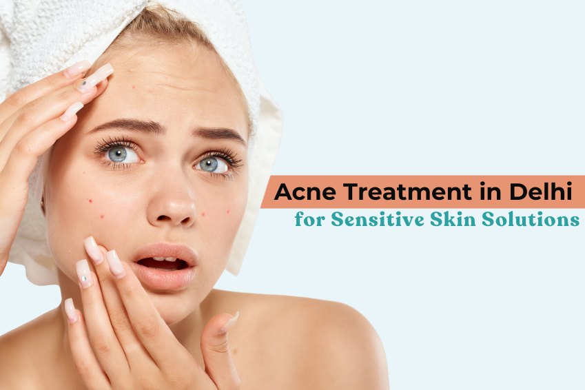 Acne Treatment in Delhi for Sensitive Skin Solutions