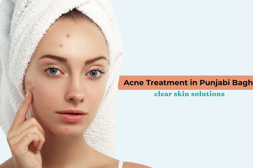 Acne Treatment in Punjabi Bagh: clear skin solutions