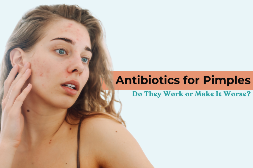 Antibiotics for Pimples: Do They Work or Make It Worse?