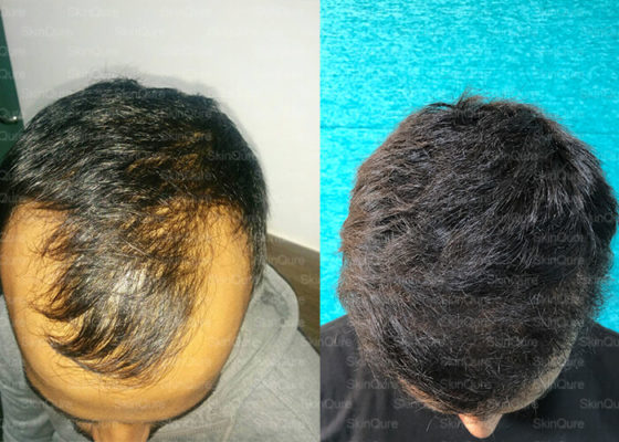 Hair loss Problems? Need Solutions!