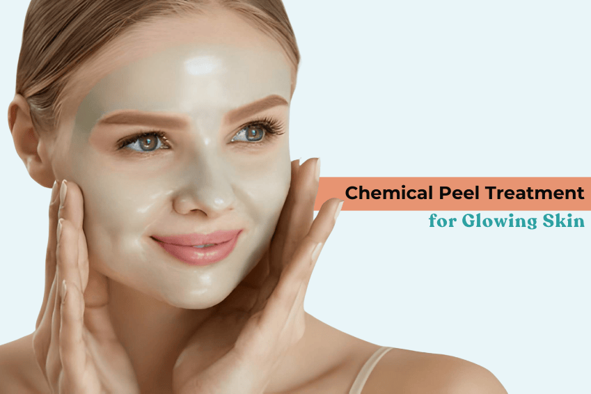 Chemical Peel Treatment in Delhi for Glowing Skin