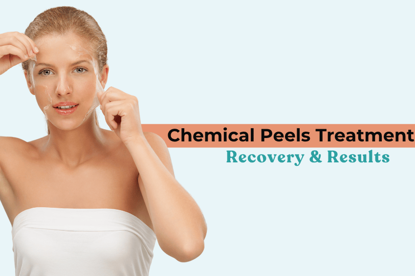 Chemical Peels Treatment in Punjabi Bagh: Recovery & Results