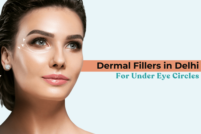 Dermal Fillers in Delhi for Under Eye Circles