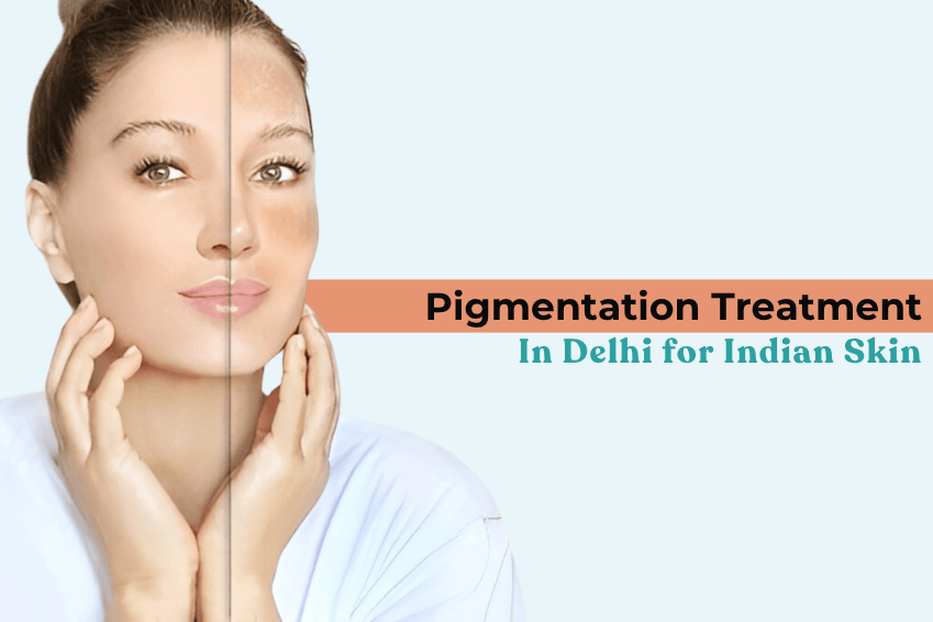 Pigmentation Treatment in Delhi for Indian Skin