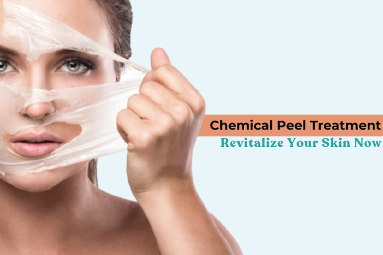 Chemical Peel Treatment: Revitalize Your Skin Now
