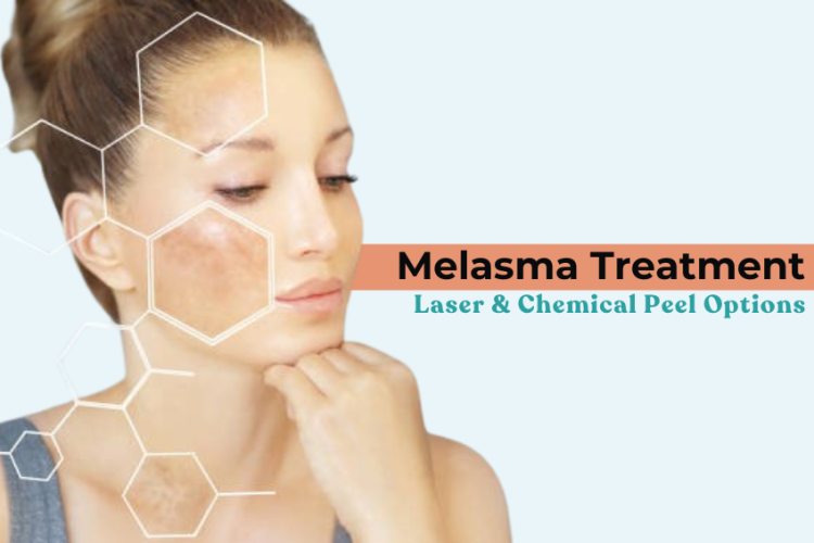 Melasma Treatment: Laser & Chemical Peel Options