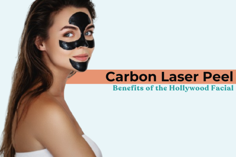 Carbon Laser Peel: Benefits of the Hollywood Facial