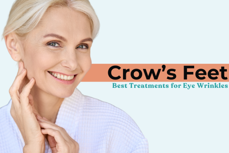 Crow’s Feet: Best Treatments for Eye Wrinkles