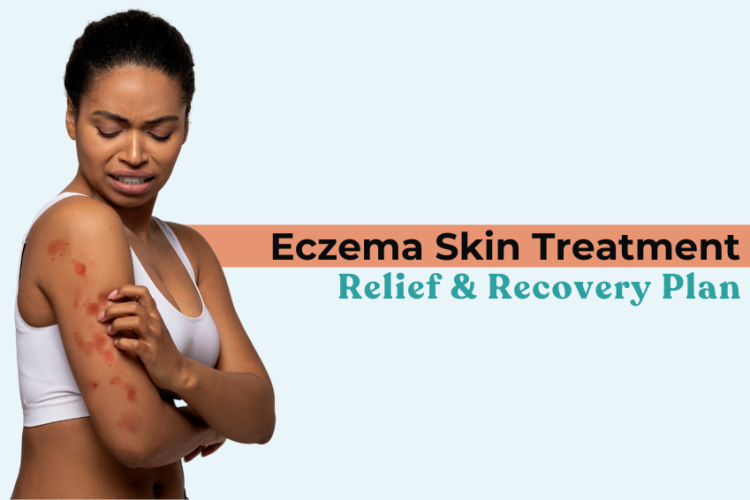 Eczema Skin Treatment: Relief & Recovery Plan