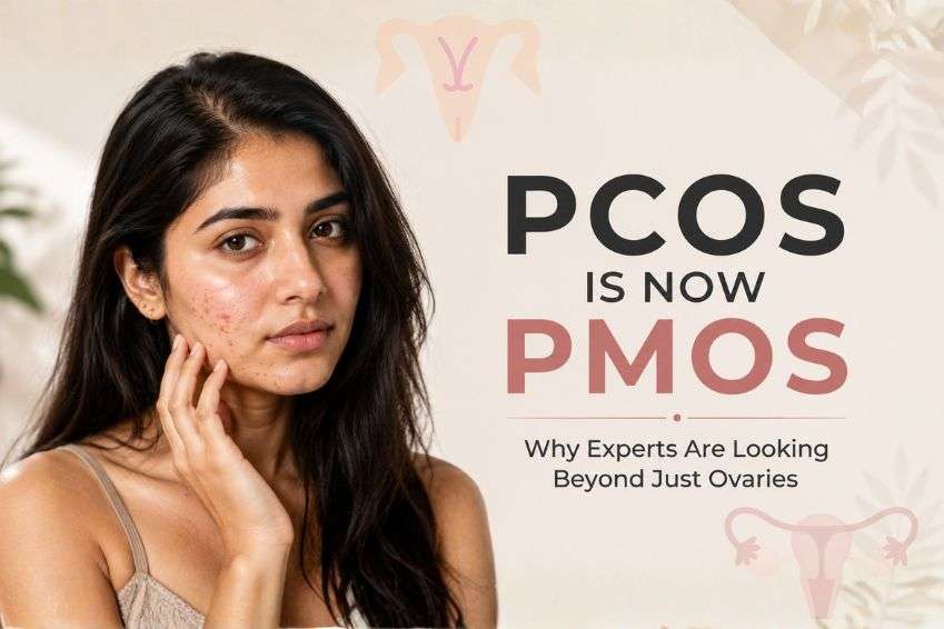 PCOS Is Now PMOS: Why Experts Are Looking Beyond Just Ovaries