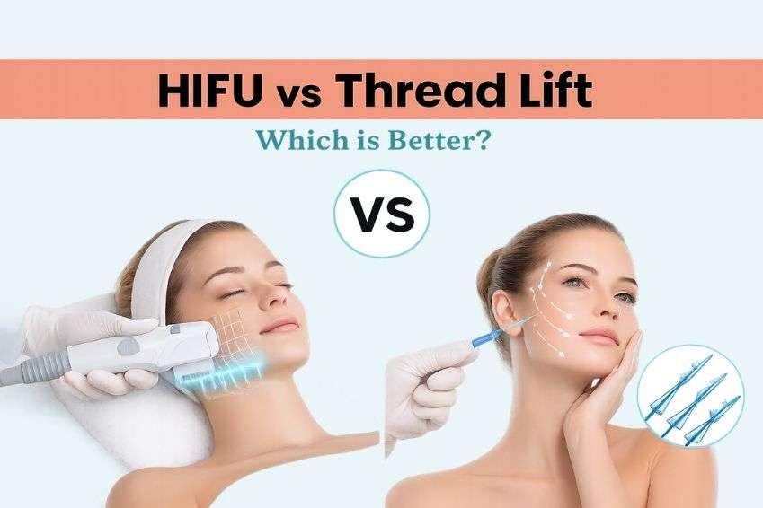 HIFU vs Thread Lift: Which Lifts Better?