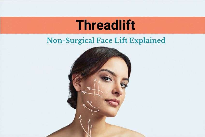 Thread Lift: Non-Surgical Face Lift Explained