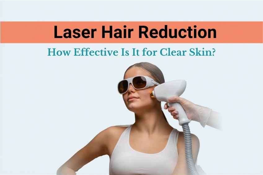 How effective is Laser Hair Reduction for Clear Skin?
